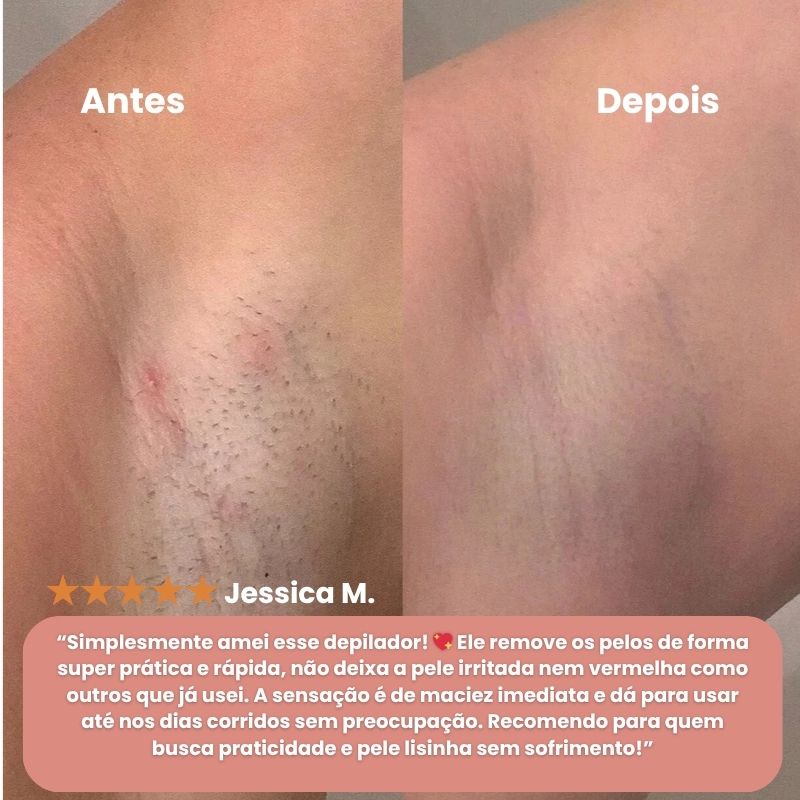 Belisse - Depilador 2 em 1